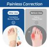 Bunion Corrector for Women & Men, Lightweight Toe Separator Splint, Wear in Shoes, Relieves Hallux Valgus Pain, Adjustable Toe Straightener Brace