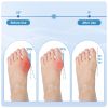 Bunion Corrector for Men and Women, Adjustable Big Toe Straightener & Alignment Splint for Hallux Valgus Pain Relief, Day and Night Support